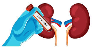 KIDNEY  TEST
